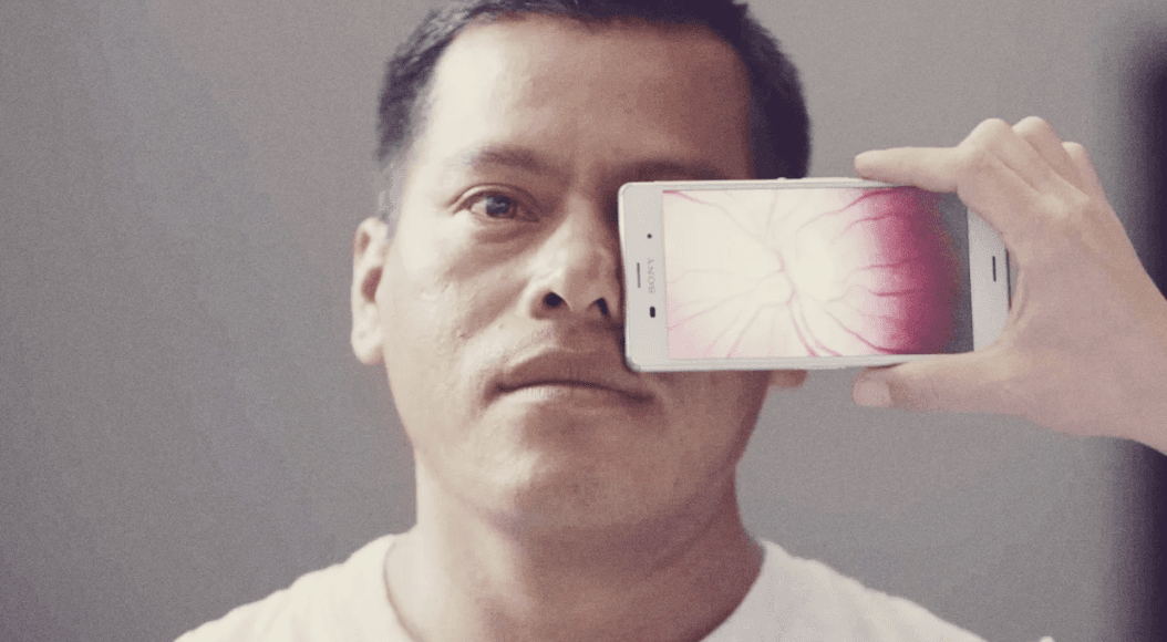 Smartphones Are Leading The Global Charge Against Blindness
