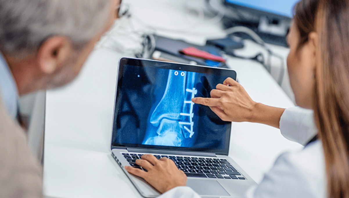 AI to Show Promising Results in Predicting Chronic, Under Diagnosed, Conditions from Standard CT Scans